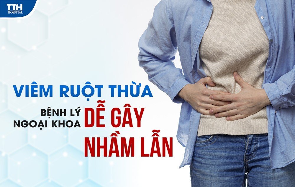 VIÊM RUỘT THỪA - BỆNH LÝ NGOẠI KHOA DỄ GÂY NHẦM LẪN